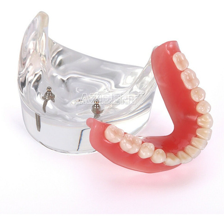 2 Modelos Sobre Dentadura Implantes Enseñanza Santiago 10