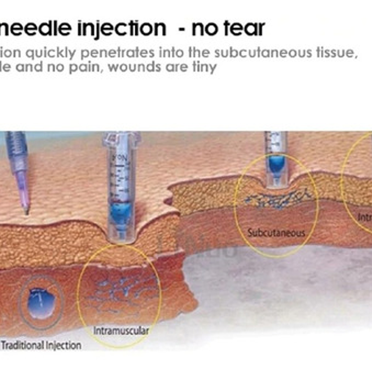 Hyaluron Pen Lápiz Hialurónico Alta Presión 2 En 1 Santiago 5