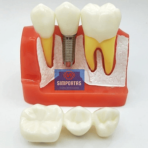 Modelo Dental Enseñanza Y Estudio Puente Gigante Santiago