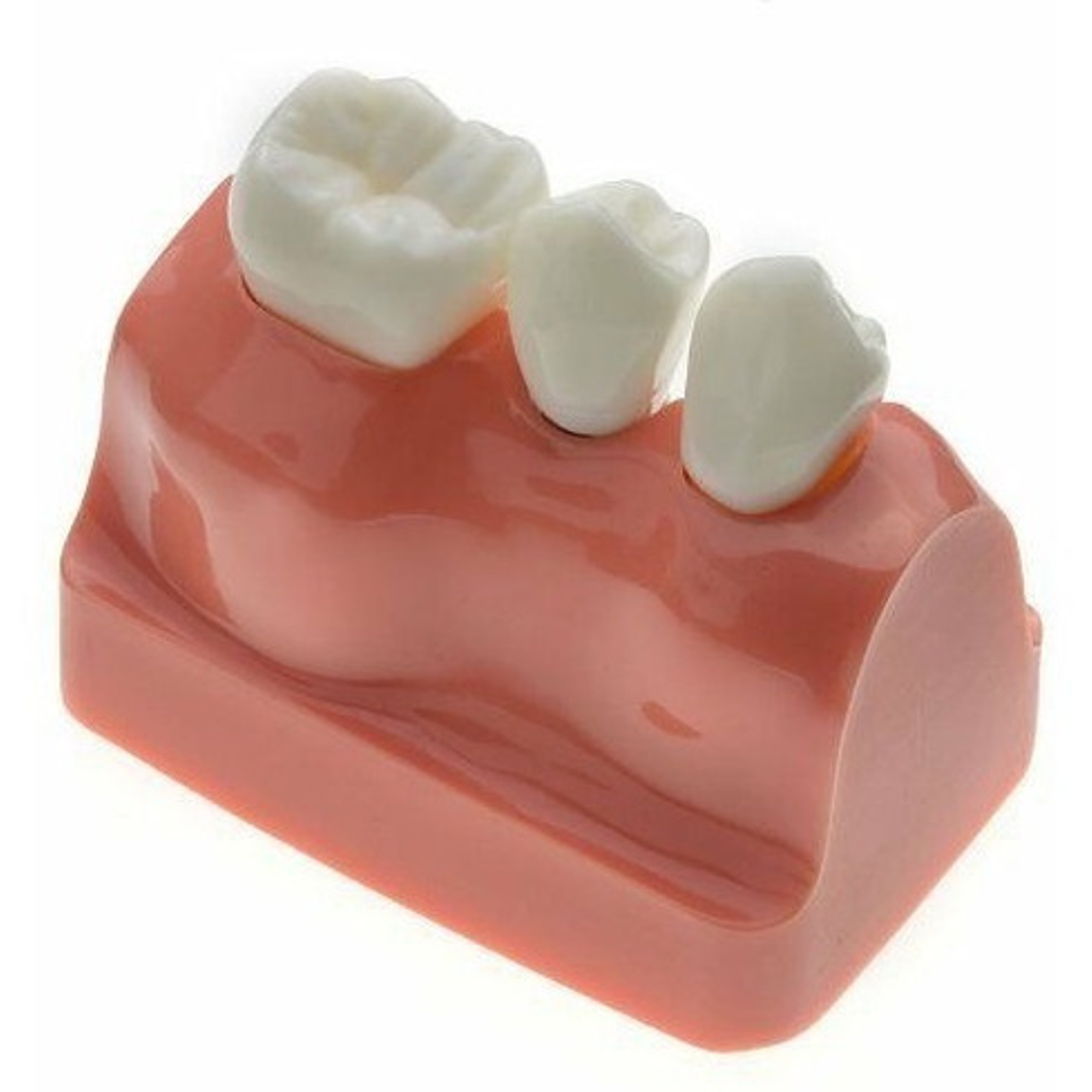 Modelo Dental Enseñanza Y Estudio Puente Gigante Santiago 6