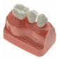 Modelo Dental Enseñanza Y Estudio Puente Gigante Santiago - Miniatura 6