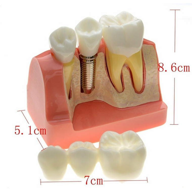 Modelo Dental Enseñanza Y Estudio Puente Gigante Santiago 7