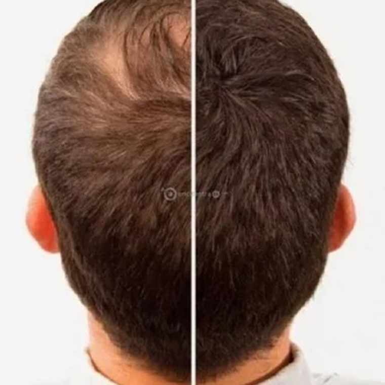 Fibras Capilar Sevich Keratina Recarga Original 100g Stgo. 10