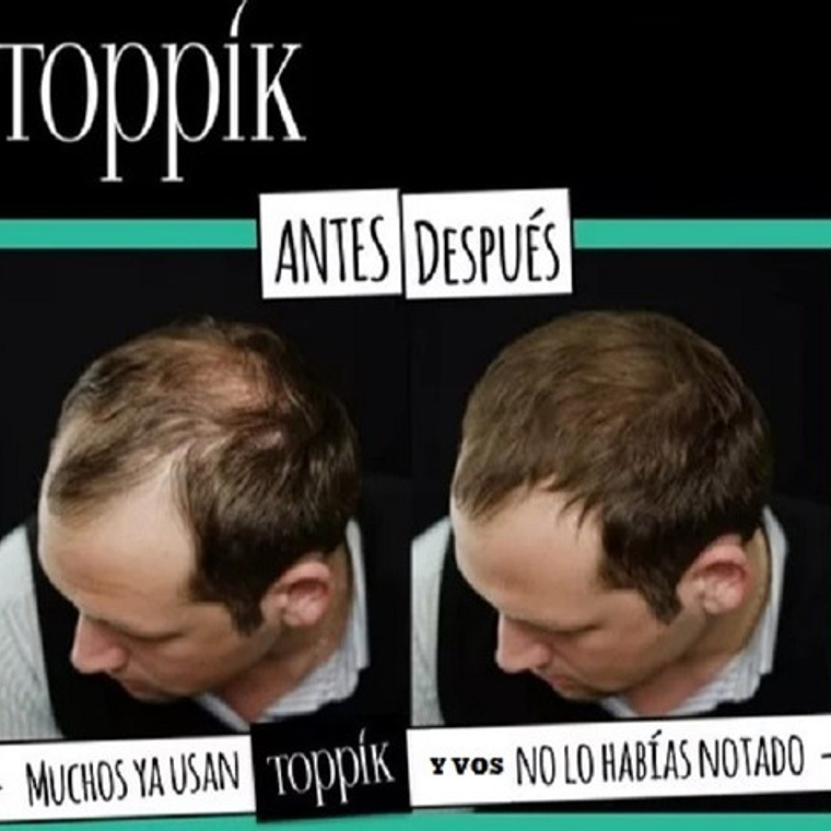 Pack Completo De Toppik 27.5g + Aplicador + Peine Santiago 42