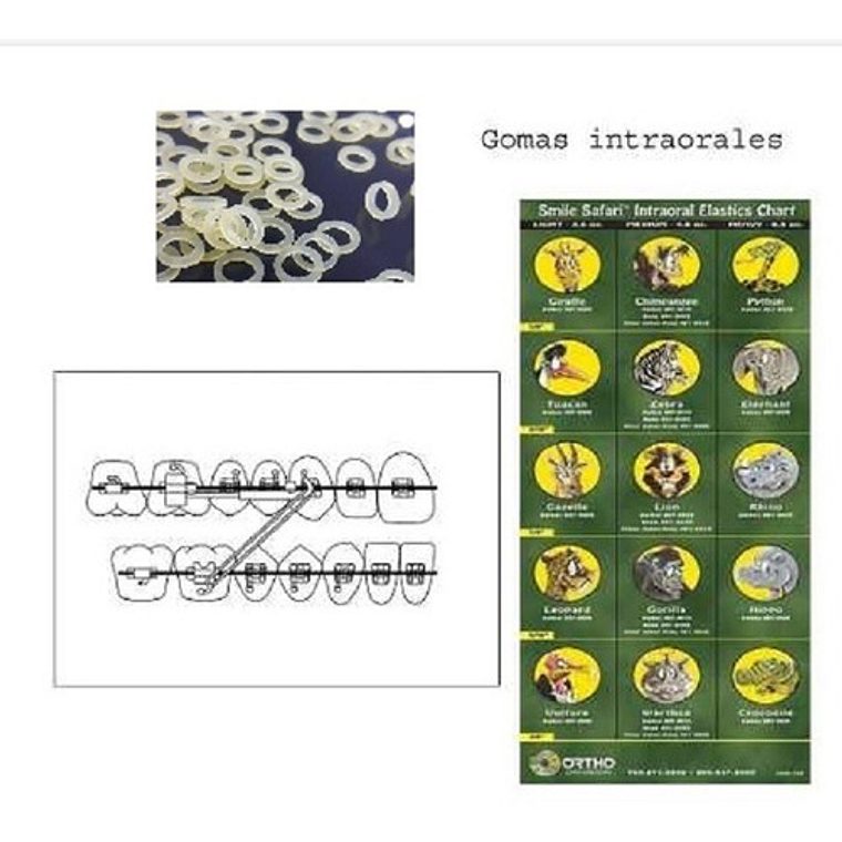 Elástico Intraoral Intermaxilares Ortodoncia 1/8 Y 3/16 Stgo 60