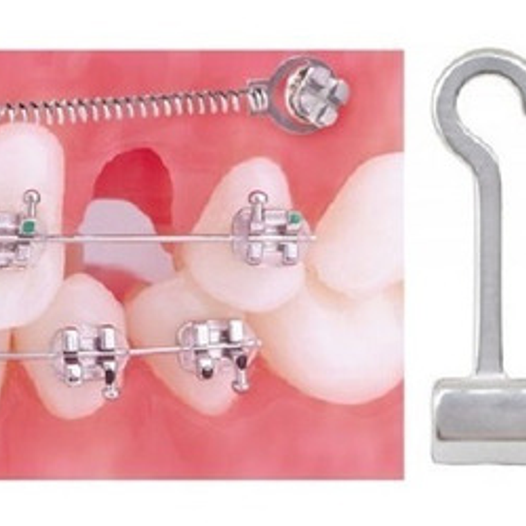 Crimpables Hook Ortodoncia Bolsita 10u Santiago 6