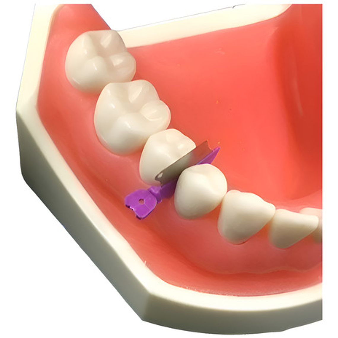 Cuñas Plásticas C/ Banda Incorporada Cajita 50u Calidad Stgo 1