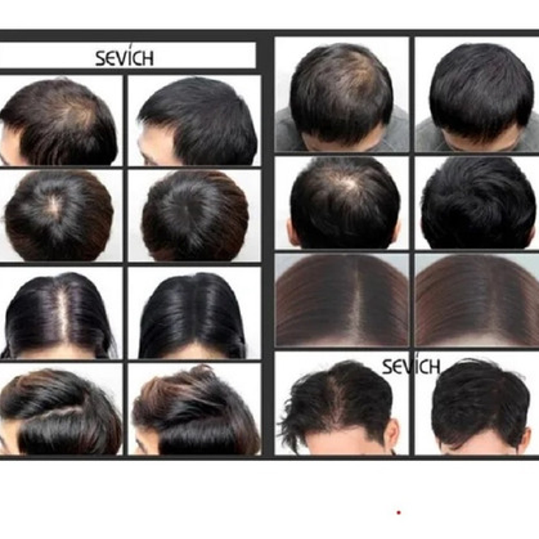 Toppik Recarga Pelo Polvo 100g No Nano Hair Fibras Santiago 21