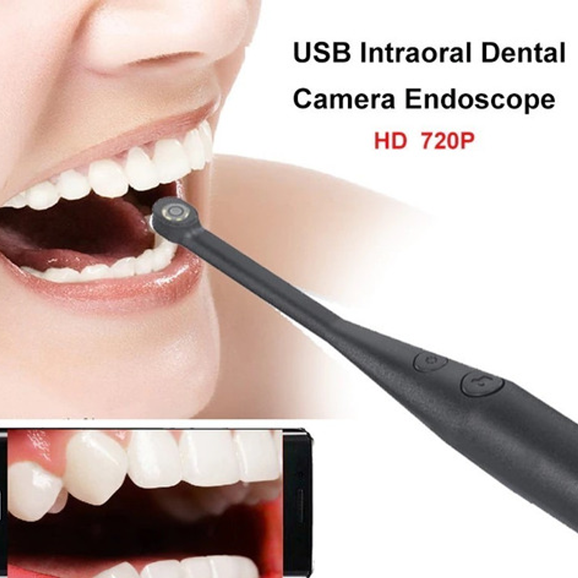 Cámara Intraoral Usb Led Celular Y Pc Calidad Santiago 2