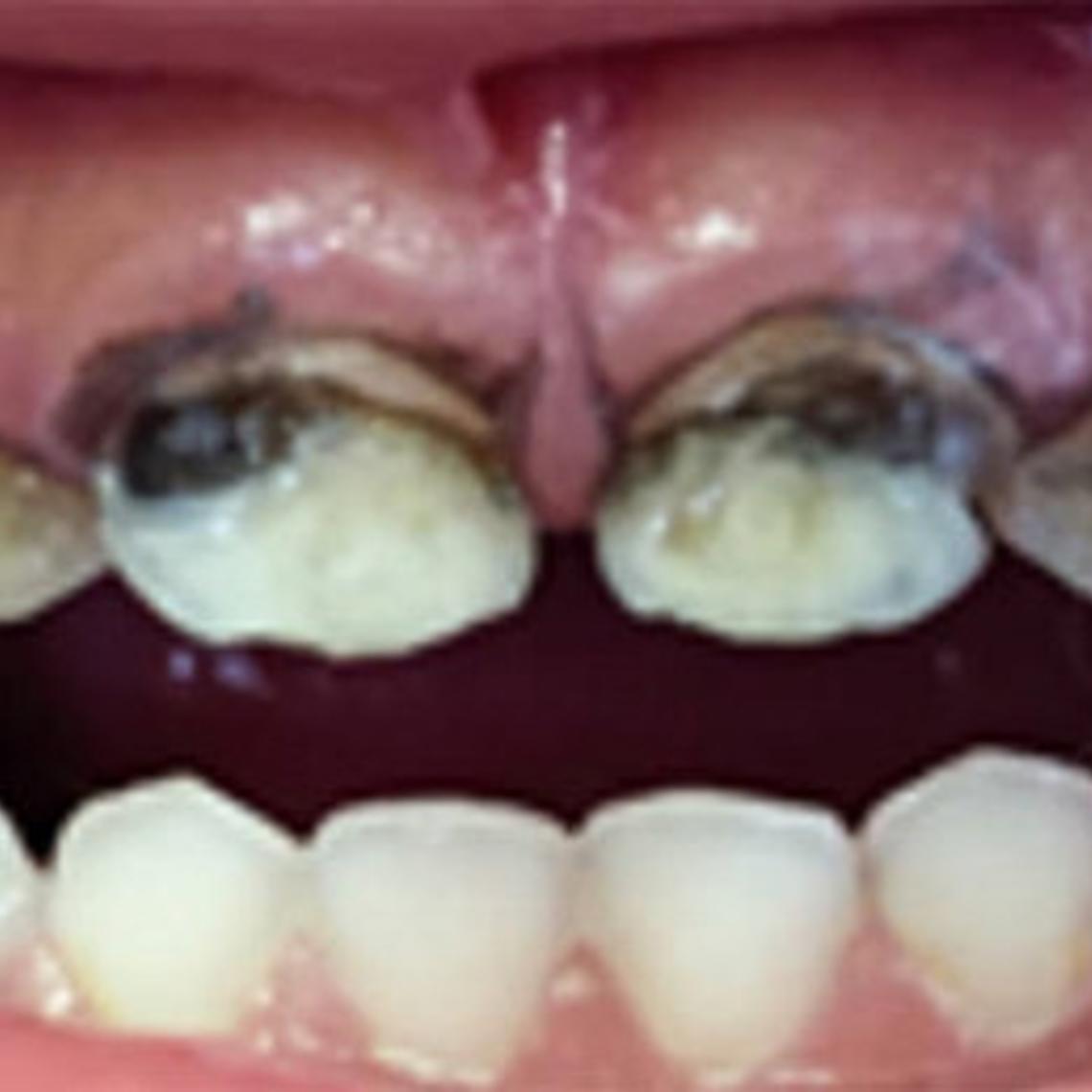 Fagamín Fluoruro Diamino Plata Dental 5ml Santiago 6