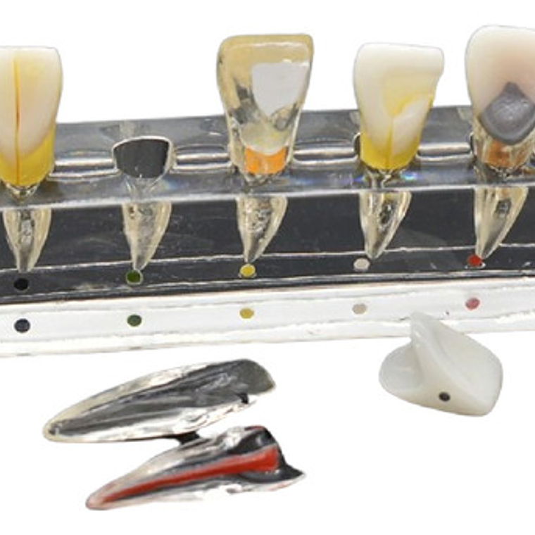 Modelo Endodoncia Dental Acrílico Enseñanza Didáctico Stgo. 1
