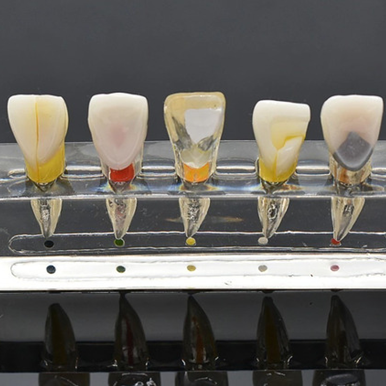 Modelo Endodoncia Dental Acrílico Enseñanza Didáctico Stgo. 4