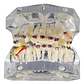 Modelo Dental Ortodoncia Brackets Acrilico Con Adm Santiago - Miniatura 1