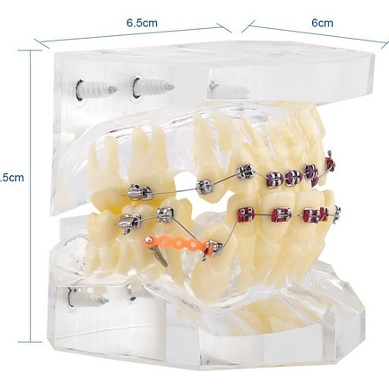Modelo Dental Ortodoncia Brackets Acrilico Con Adm Santiago 2
