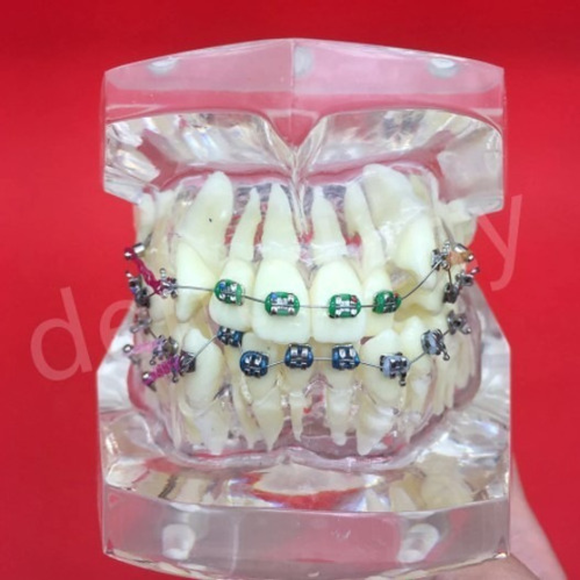 Modelo Dental Ortodoncia Brackets Acrilico Con Adm Santiago 4
