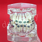 Modelo Dental Ortodoncia Brackets Acrilico Con Adm Santiago - Miniatura 4