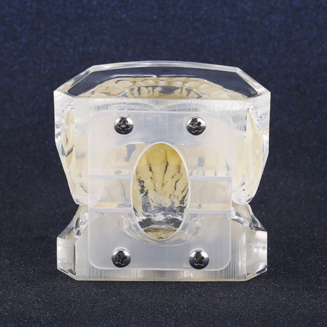 Modelo Dental Ortodoncia Brackets Acrilico Con Adm Santiago 6