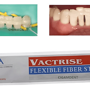 Banda De Refuerzo Dental Tira De Fibra Tipo Ribbond Calidad