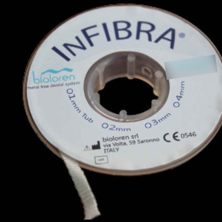 Banda De Refuerzo Dental Tira De Fibra Tipo Ribbon 1 Rollo 5