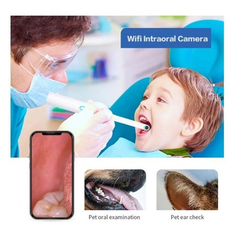 Camara Intraoral Wifi Inalámbrica Led Santiago 3