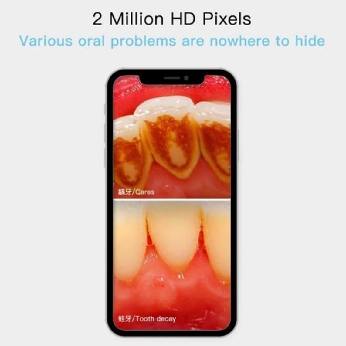 Camara Intraoral Wifi Inalámbrica Led Santiago 7