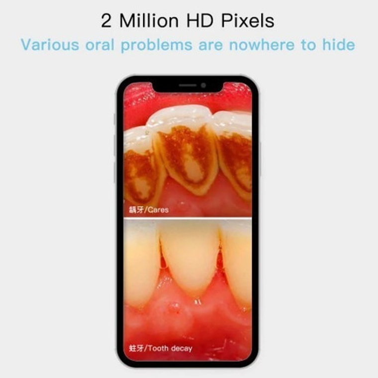 Camara Intraoral Wifi Inalámbrica Led Santiago 7