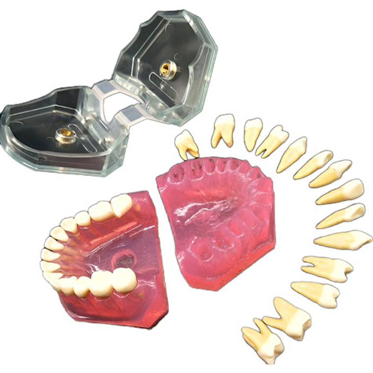 Modelo Acrílico Único Dientes Desmontables Encía Enseñanza  1