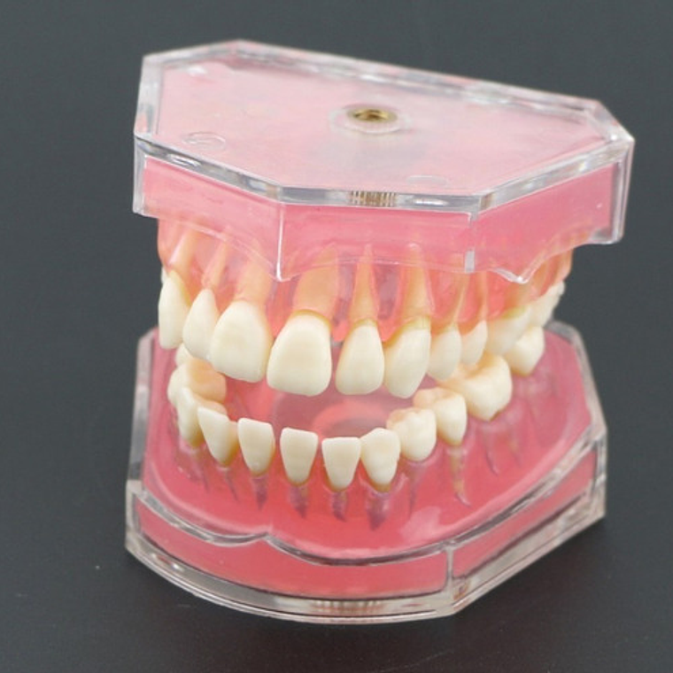 Modelo Acrílico Único Dientes Desmontables Encía Enseñanza  3
