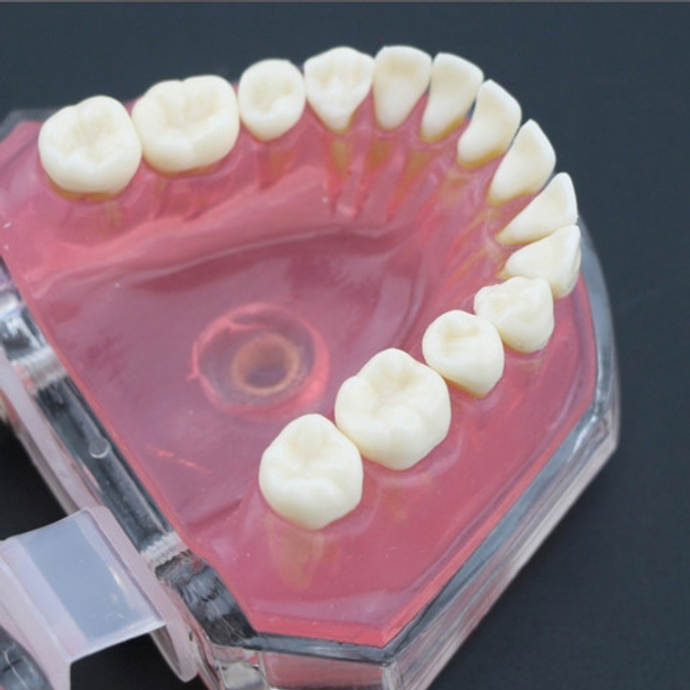 Modelo Acrílico Único Dientes Desmontables Encía Enseñanza  6
