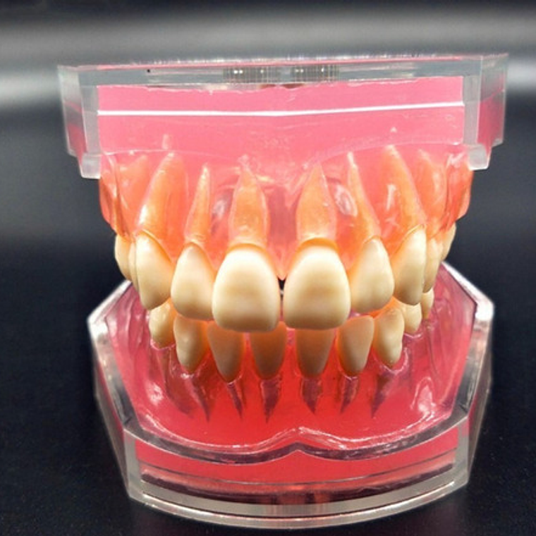 Modelo Acrílico Único Dientes Desmontables Encía Enseñanza  8