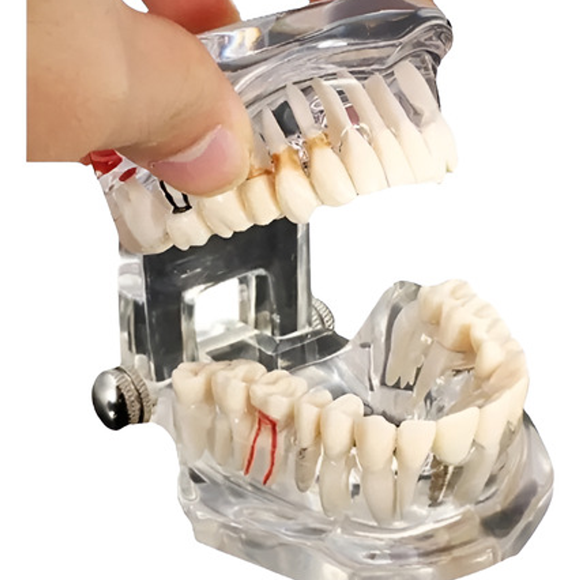 Modelo Dental Enseñanza Y Tratamientos Implantes Protesis 1