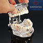 Modelo Dental Enseñanza Y Tratamientos Implantes Protesis - Miniatura 2