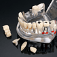 Modelo Dental Enseñanza Y Tratamientos Implantes Protesis - Miniatura 5