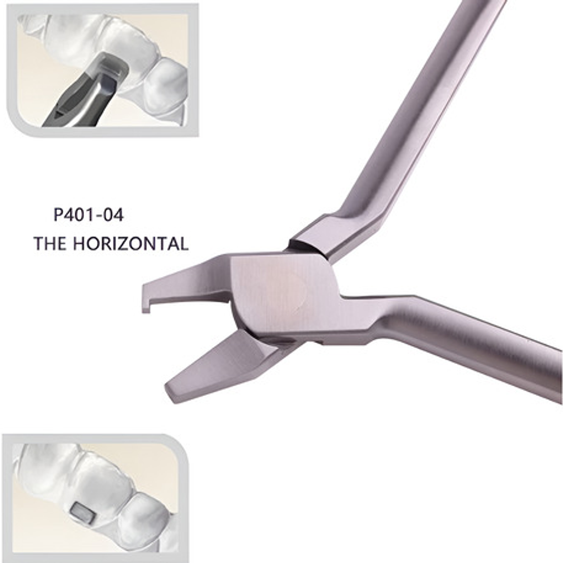 Alicates Alineadores Invisibles Ortodoncia Modelos Santiago 8