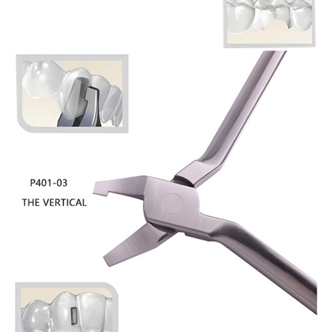 Alicates Alineadores Invisibles Ortodoncia Modelos Santiago 10