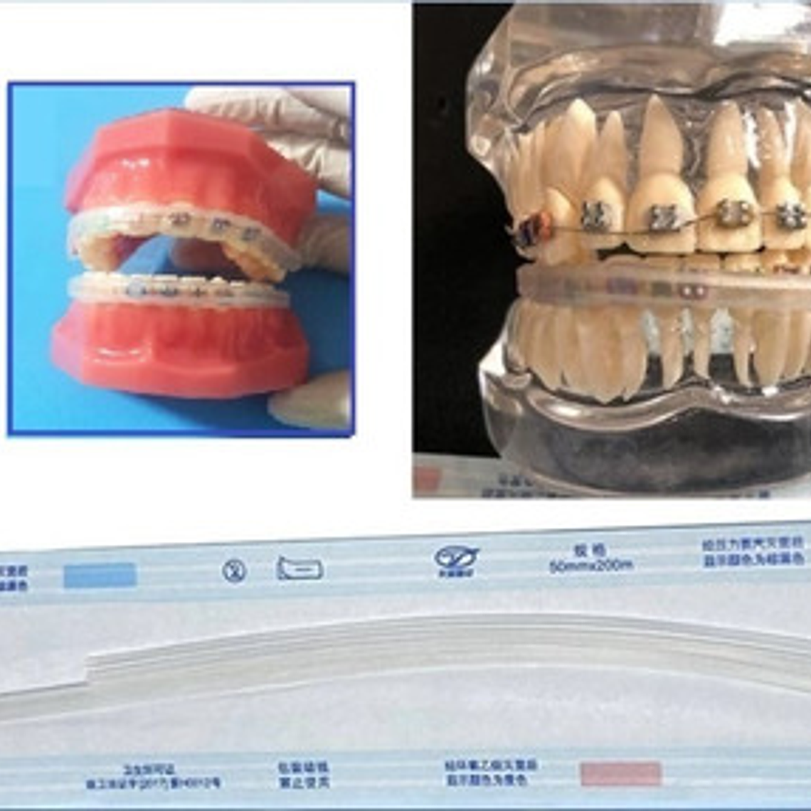 Protección Para Ortodoncia Bracket Protege Labios Y Mejillas 2