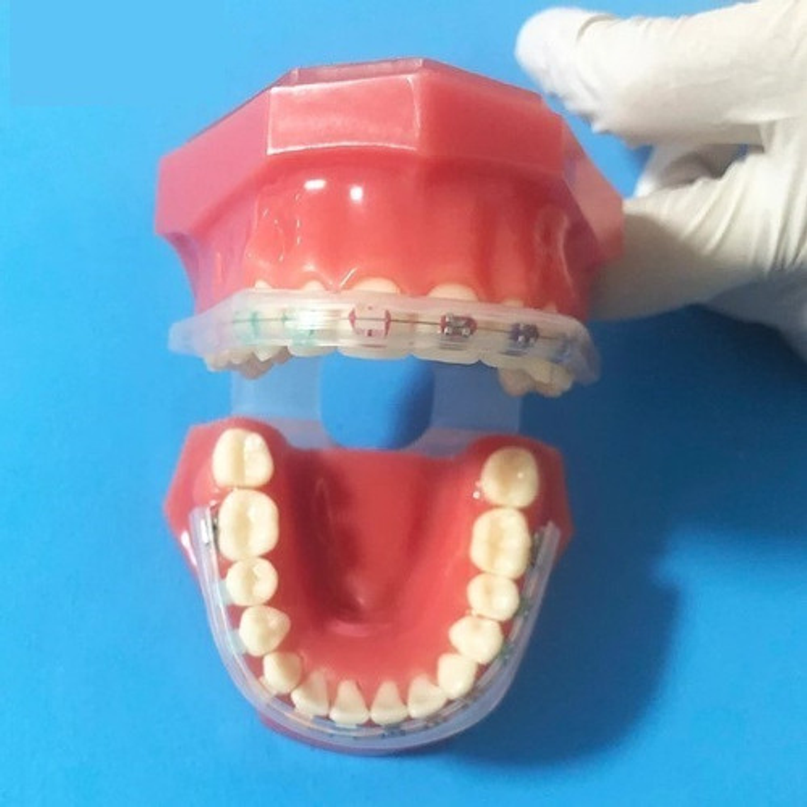 Protección Para Ortodoncia Bracket Protege Labios Y Mejillas 4