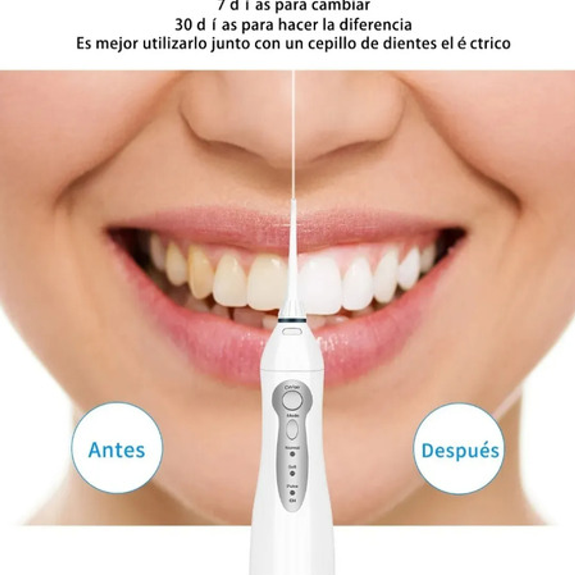 Irrigador Bucal Dental Waterpik Recargable El Mejor Stgo. 11
