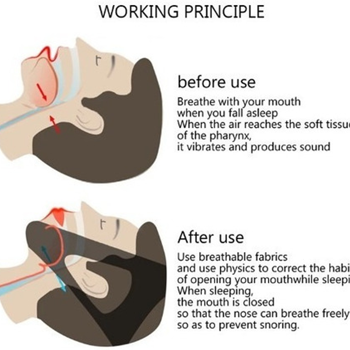 Banda Cinturón Anti Ronquido / Unisex Antibruxismo De Cabeza 5