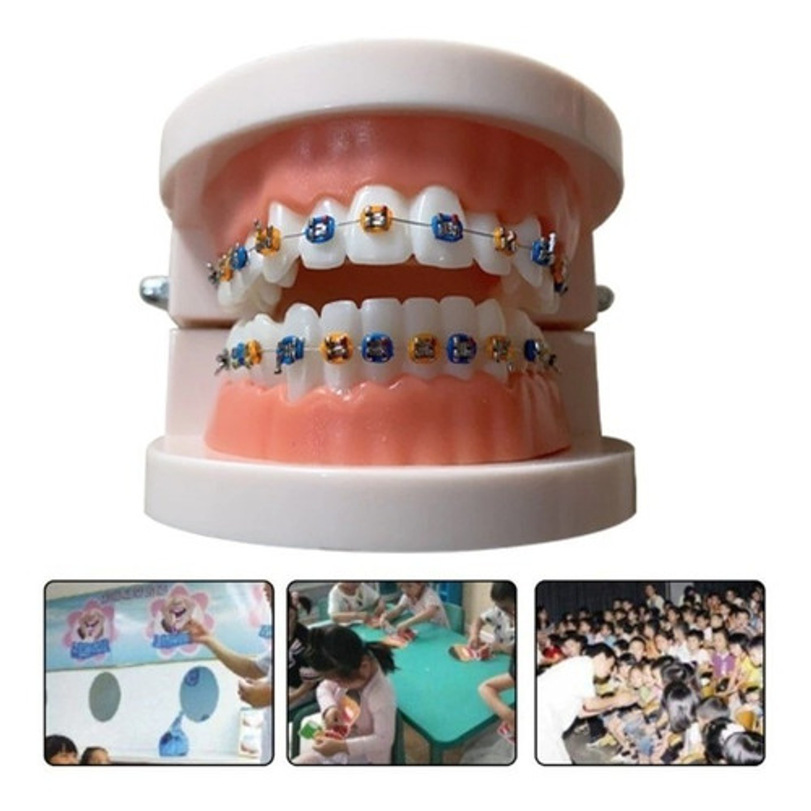 Modelo Dental Ortodoncia Enseñanza Brackets Metálicos Stgo. 3