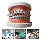 Modelo Dental Ortodoncia Enseñanza Brackets Metálicos Stgo. - Miniatura 3