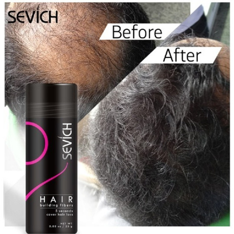 Fibras Sevich Naturales Relleno Calvicie Colores 25g Stgo. 2