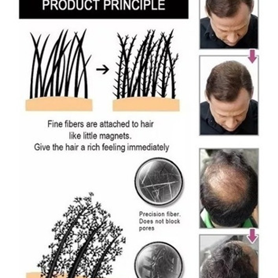 Fibras Sevich Naturales Relleno Calvicie Colores 25g Stgo. 8