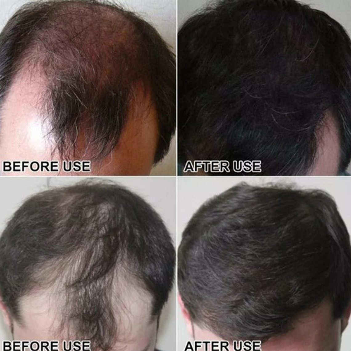 Fibras Sevich Naturales Relleno Calvicie Colores 25g Stgo. 17