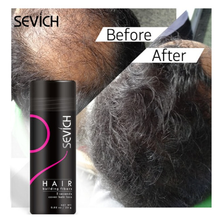 Fibras Sevich Naturales Relleno Calvicie Colores 25g Stgo. 20