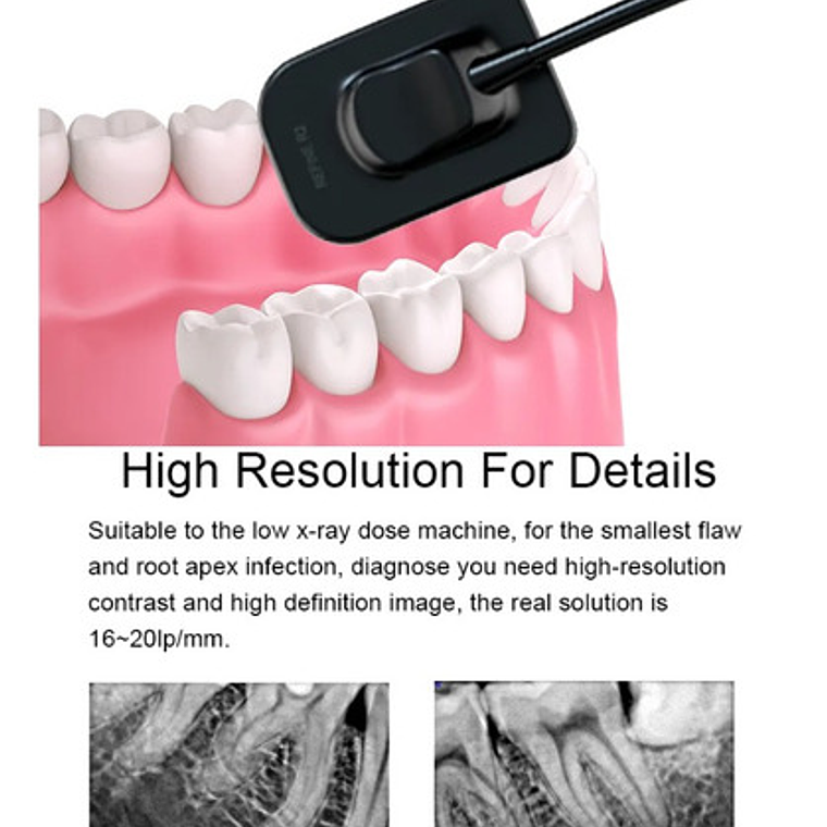 Sensor De Rayos X Handy Hdr 500 Odontología Calidad Santiago 4