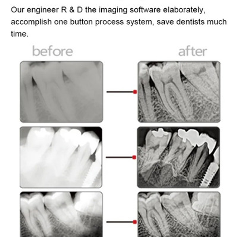 Sensor De Rayos X Handy Hdr 500 Odontología Calidad Santiago 7