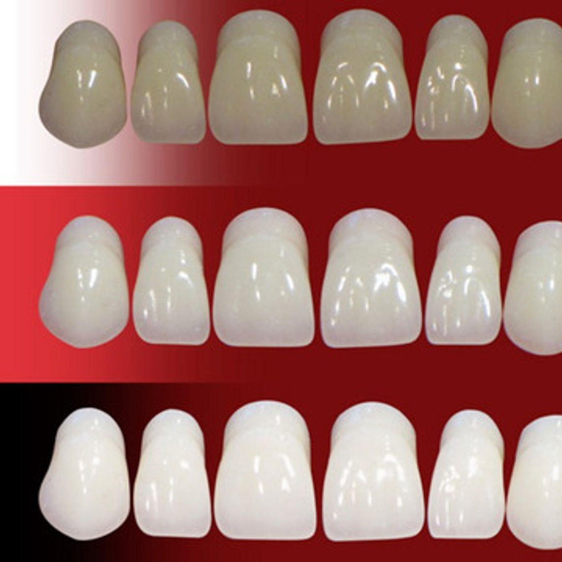 Muestrario De Colores Dental Para Dientes Marche 2