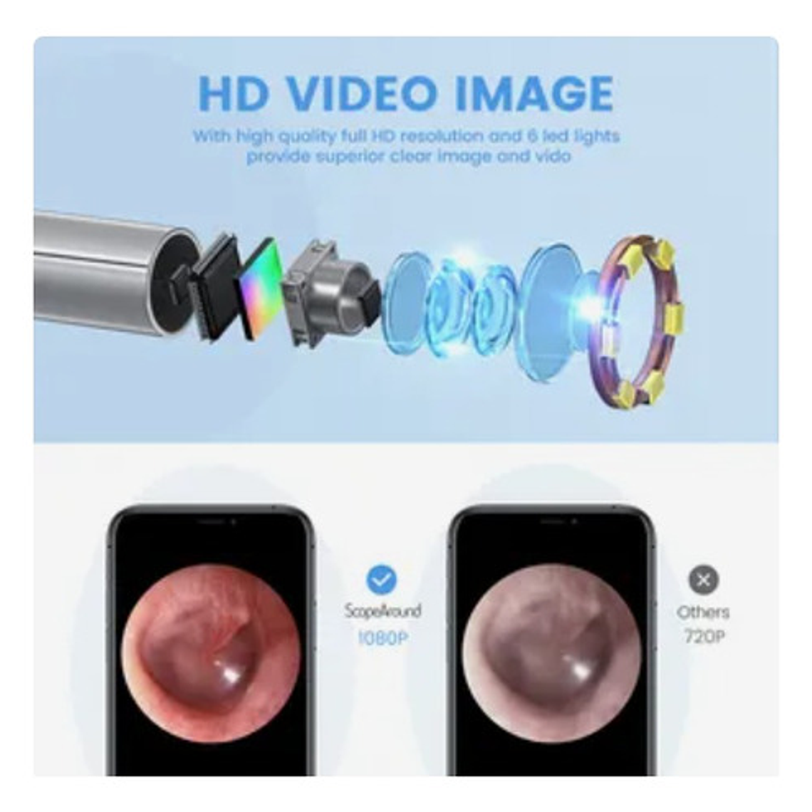Otoscopio Inalámbrico Wifi Cámara Oído Luz Led Recargable 9