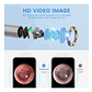 Otoscopio Inalámbrico Wifi Cámara Oído Luz Led Recargable - Miniatura 9